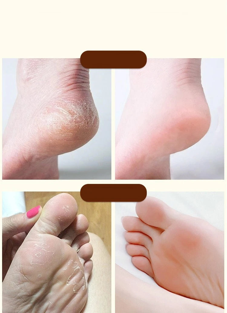 Ma You Qing Foot Cream, Moisturizing Foot Cream, Suitable for Dry Skin, Suitable for Hand and Foot Care for Dry Hands and Feet