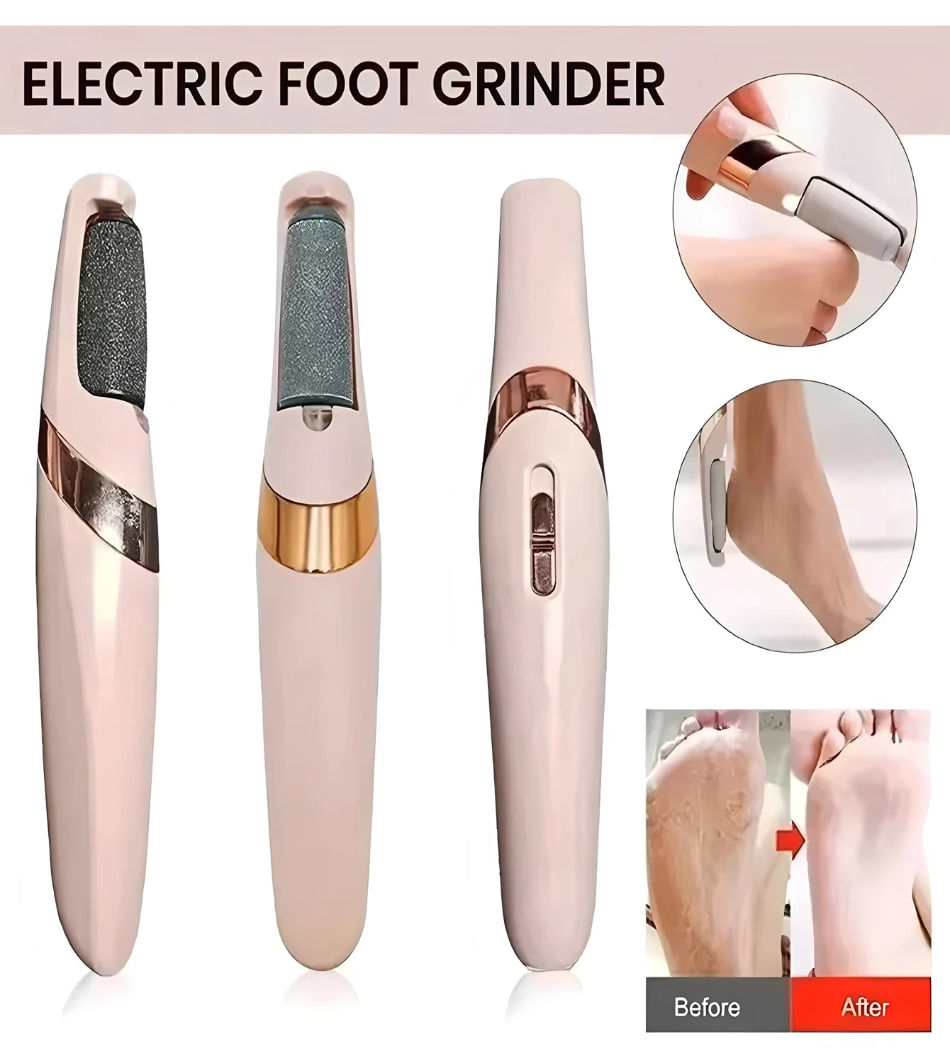 Cordless Rechargeable Electric Callus Remover, Foot File for Dry Coarse Skin Removal on Heels, for Women & Men